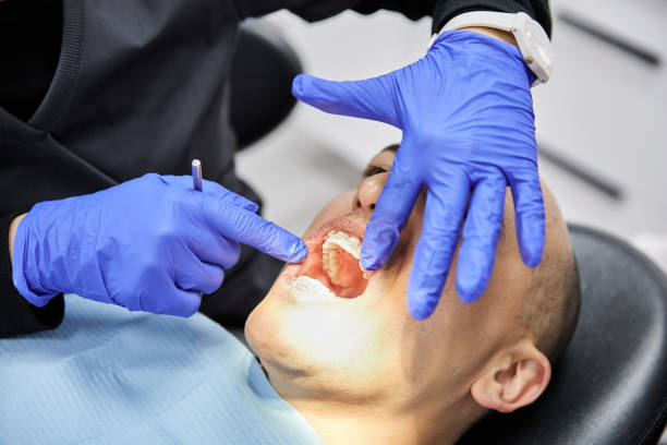 Best Broken or Cracked Tooth Emergency Dentist in East Freehold, NJ